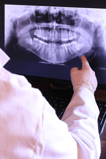 Best Emergency Root Canal Therapy in Harper, TX