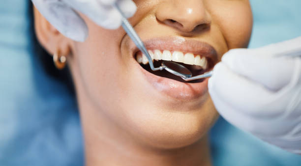Best Broken or Chipped Tooth Repair in Harper, TX